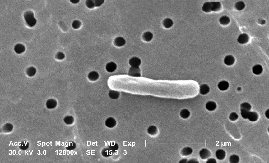 Escherichia coli